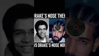 Rick Ross Says Drake Got A BBL Nose Job 😂😂😂