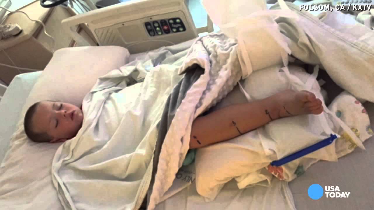 Pregnant mom sucks rattlesnake venom from son's leg - YouTube