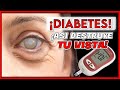 Los PRIMEROS SÍNTOMAS de RETINOPATÍA DIABETICA|| ¡PÉRDIDA de VISIÓN por DIABETES!