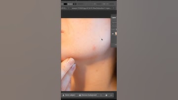 “Remove Pimples in Photoshop – Face Retouch in 30 Seconds! ✨ #shorts”