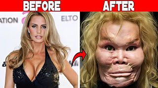 50 Celebrities Plastic Surgery Disasters You Won’t Believe!