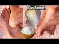HOW TO REMOVE DEAD SKIN FROM YOUR FEET NATURALLY AT HOME 2023| CRACKED HEELS HOME REMEDY