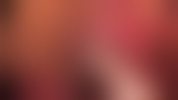 Asvide: Subxiphoid RUL lobectomy in a patient with interrupted IVC with azygos continuation