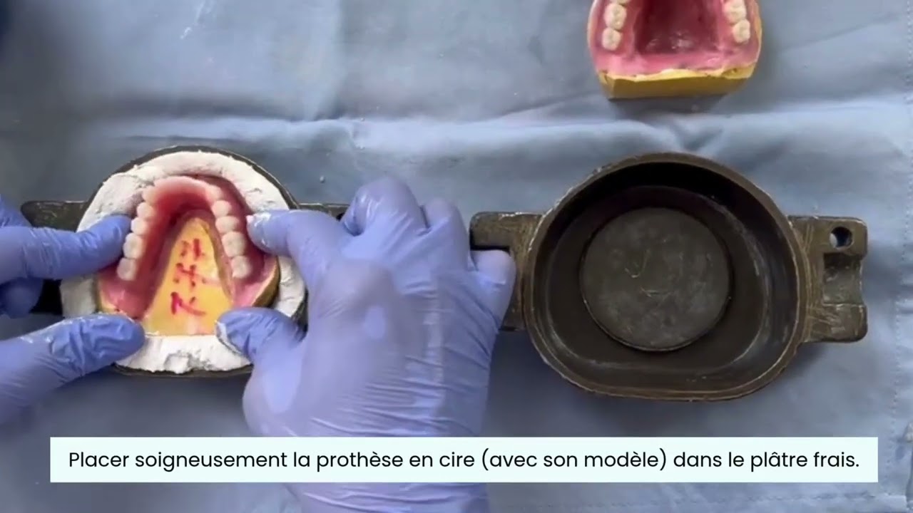 mise en moufle et polymérisation