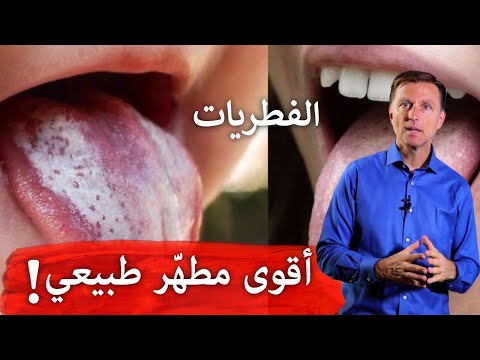 فيديو: ما الذي يمكن أن يسبب المبيضات البيض؟