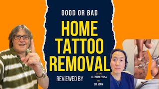 Home tattoo Removal Using Salt  Reviewed by Dr. Messina \& Dr. Youn, Is It Safe?