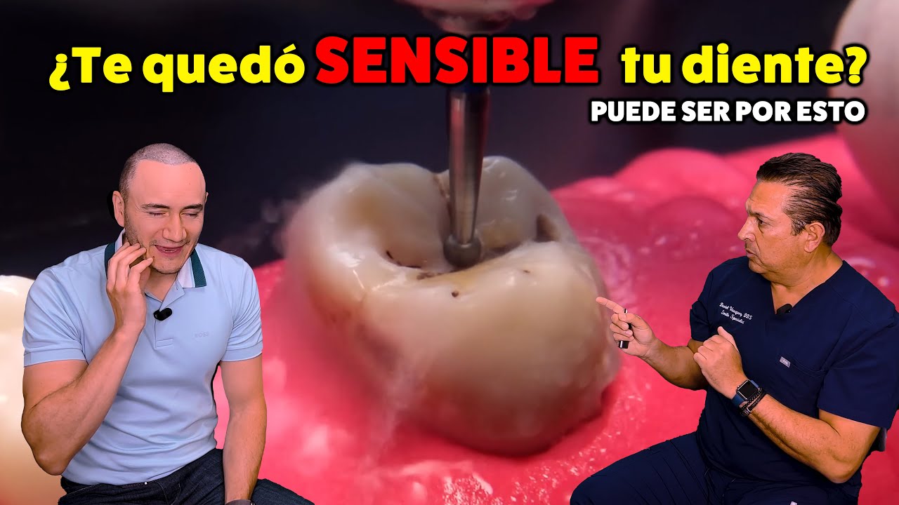 ¿Tienes sensibles tus dientes con resinas/empastes? Causa y Solución posibles | IDS