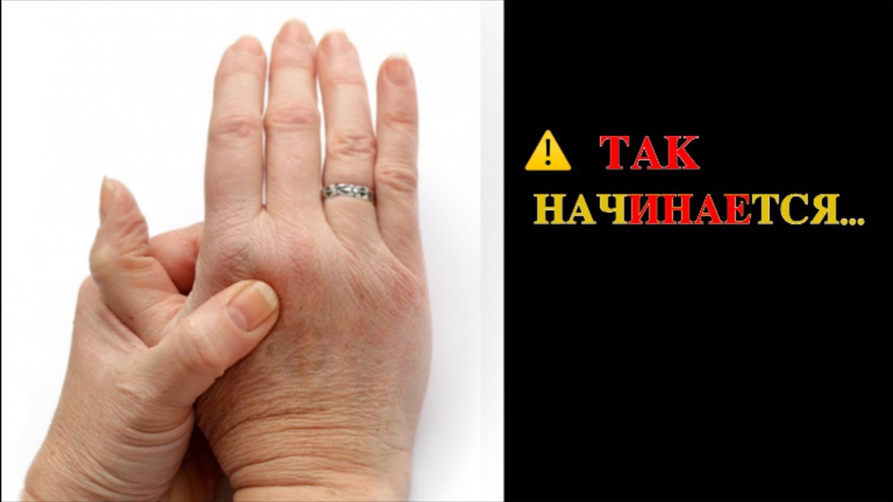 Зря игнорируете. Это ОПАСНЫЙ СИГНАЛ.