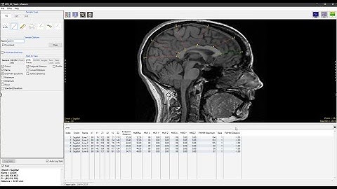 Analyze 14.0 - Measure: Sample Lines