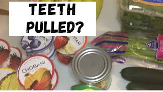 What to Eat After Tooth Extraction | Survival Guide I Just Had Teeth Extracted