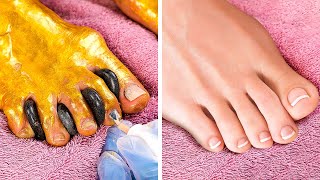 Amazing Foot Transformation || Foot Spa and Pedicure You'll Love
