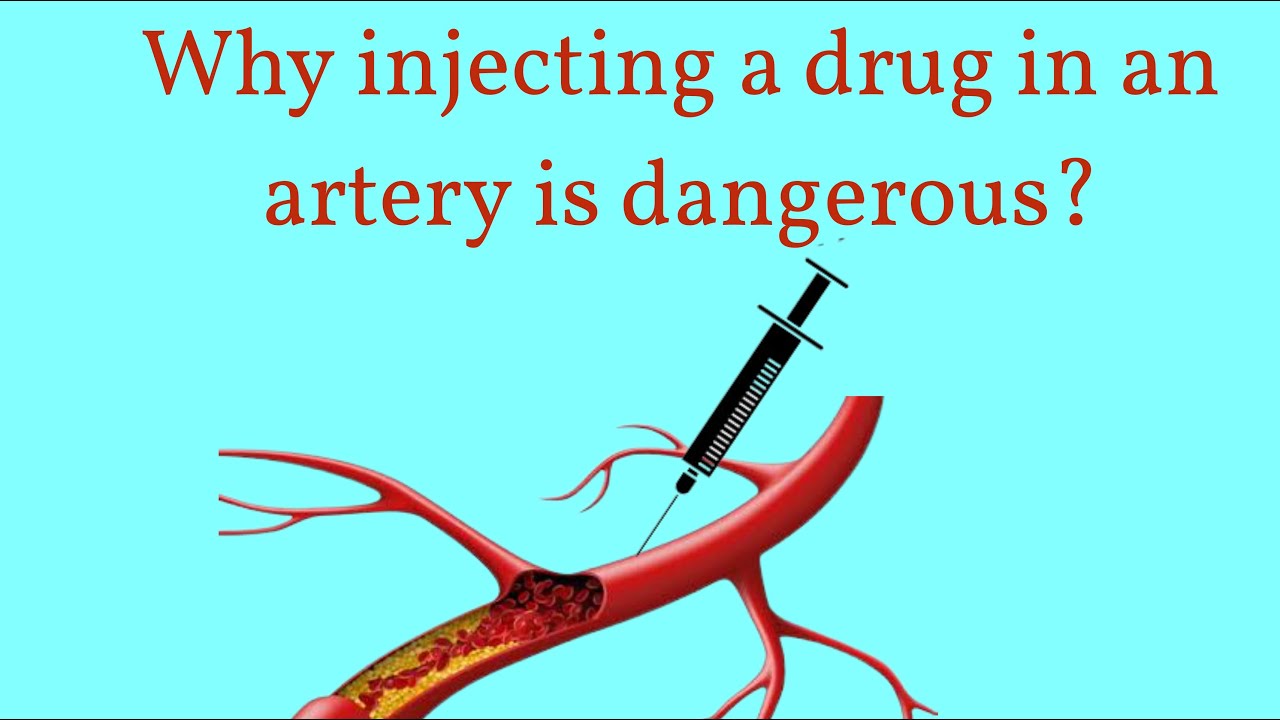 Why injecting a drug in an artery is dangerous? - YouTube