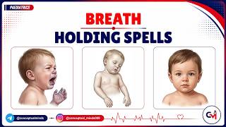 69. Breath-Holding Spells Pediatrics | Types, Clinical Features, Diagnosis & Management