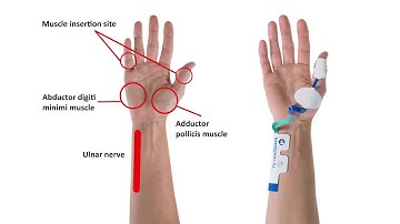 TetraGraph Instructional Video