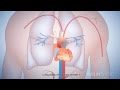 The 50-year quest to replace warfarin: by Nature Video