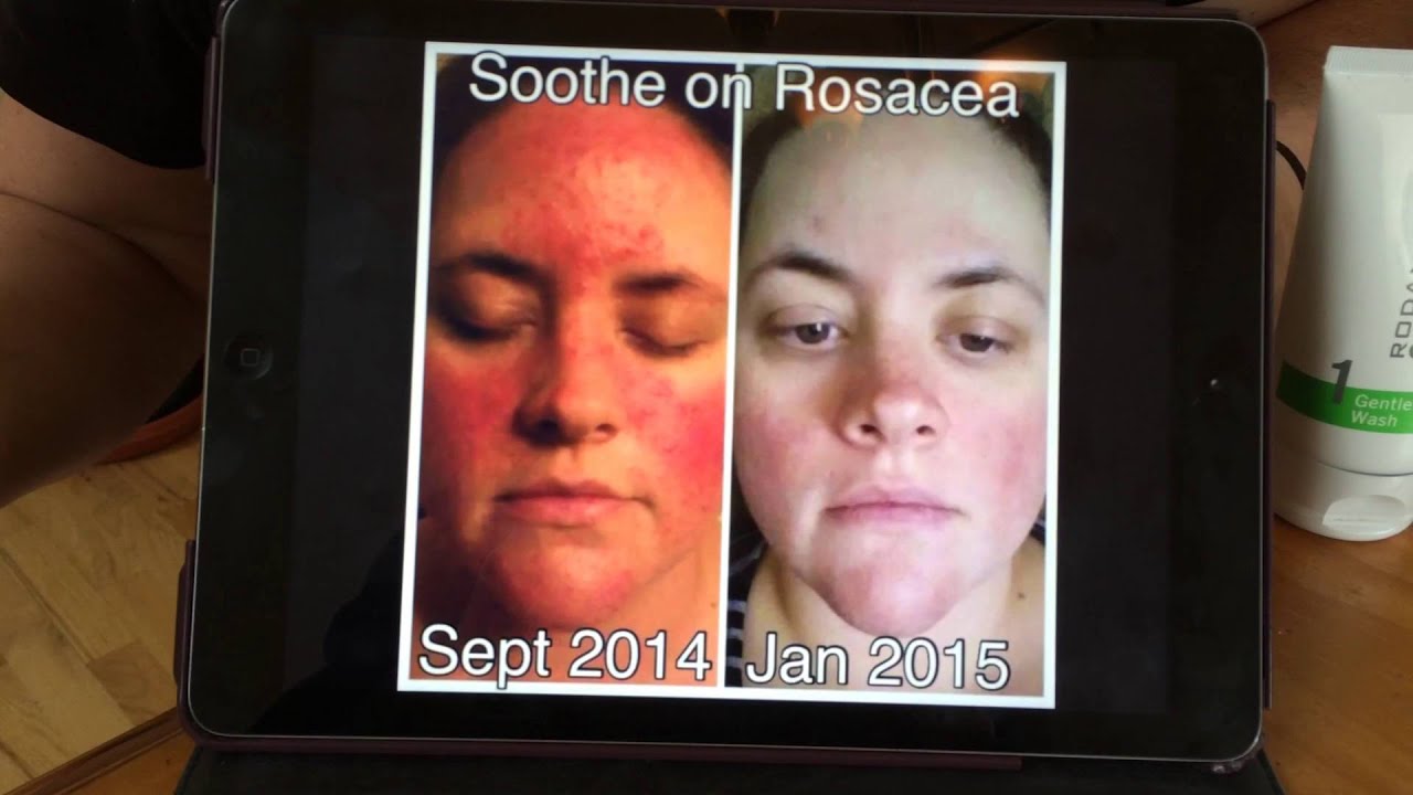 Rodan + Fields - Soothe Regimen