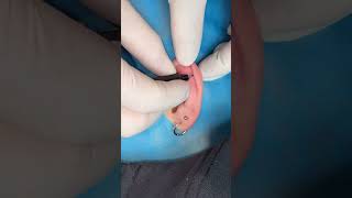 ear piercing #nosepiercing #earpiercing  #piercings # #earrings