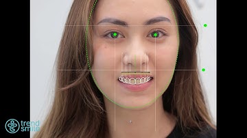 TrendSmile - Thiết kế nụ cười, Kiến tạo tương lai