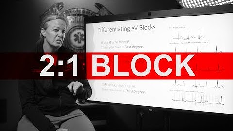 2:1 AV Block
