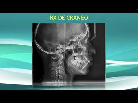Video thumbnail: ANATOMIA EN RADIOLOGIA