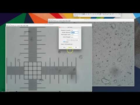 Adding A Scale Bar In Imagej Full Youtube