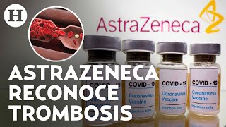 ¿Qué es y cuáles son los síntomas de la trombosis, enfermedad ligada a la vacuna de AstraZeneca?