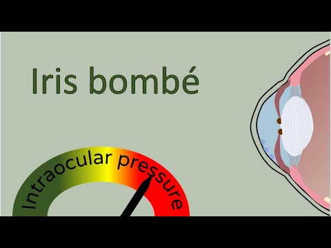 Video: Iris Bombe V Kategórii Psy Problémy S Očami Kompletné Zadné Synechie