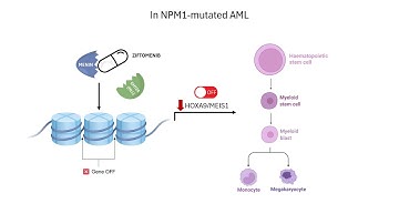 How Ziftomenib Works: The First Menin Inhibitor for NPM1-Mutated Acute Myeloid Leukemia