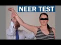 Neer Test (Neer Sign) for Subacromial Shoulder Pain (Shoulder Impingement) Syndrome