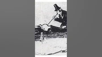 Shocking Ways Of The Past Why Did You Perform This Procedure Shorthistory 