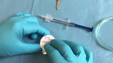 Loading of the Accuject BL Injector with the Acunex lens