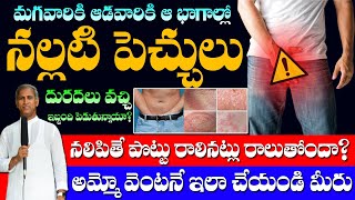 How To Remove Private Part Itching Overnight | Fungal Infections | Dr Manthena Satyanarayana Raju