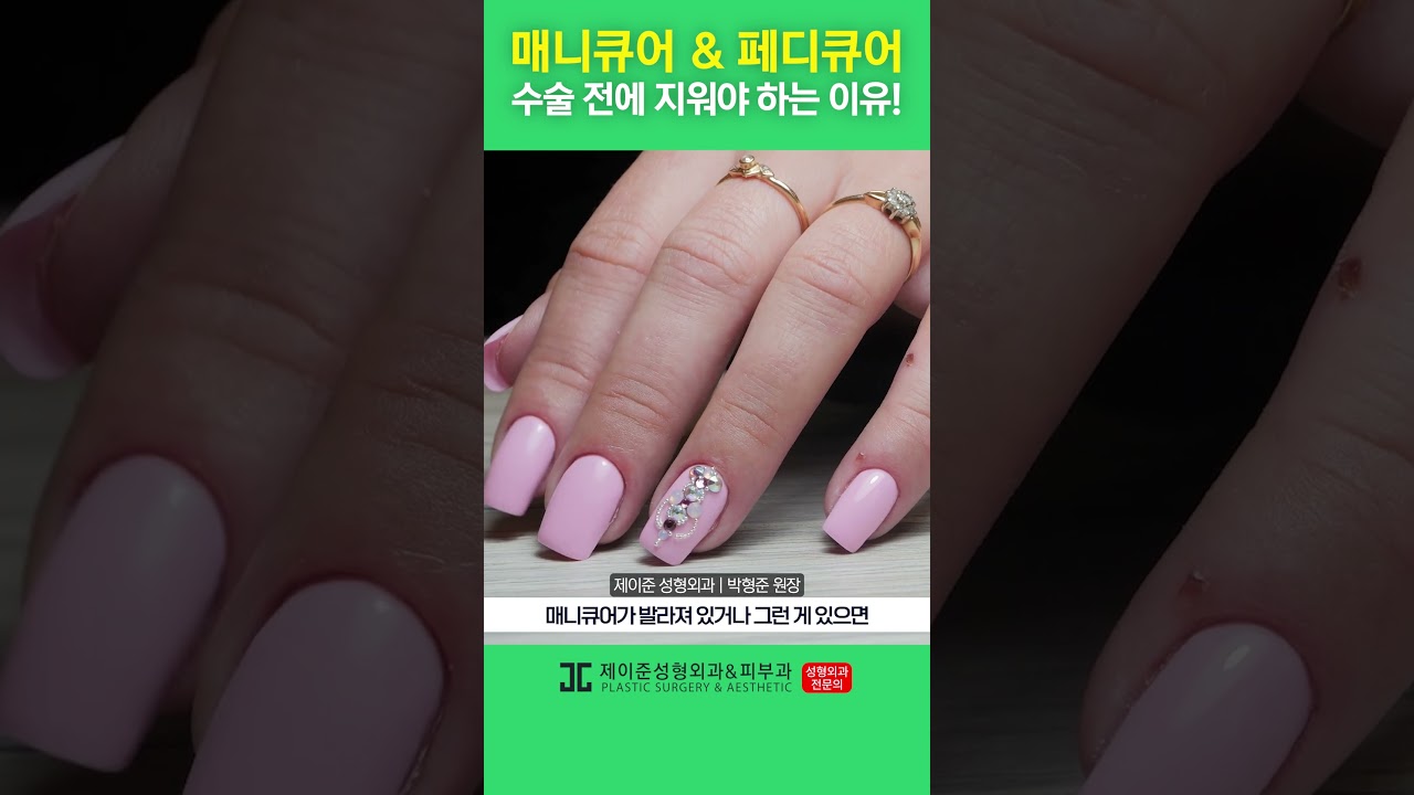 [제이준 성형외과 피부] Lý do phải xóa móng tay và móng chân! #shorts