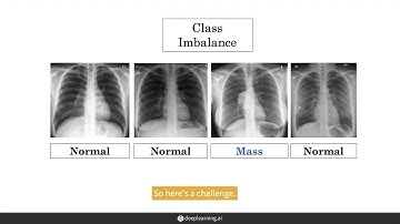 Practical Challenges Training with Medical Data (AI For Medicine)