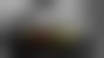 MIS-TLIF (3d O-arm navigation); L4-S1 (Minimally invasive Transforaminal Lumbar inter body fusion)