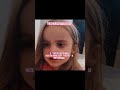 Poor Blakeley… #youtubeshorts #toddlersoftiktok #trending #shorts #fyp #fanpage