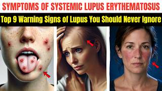 Top 9 SILENT Symptoms Of Systemic Lupus Erythematosus (Doctors Never Say This)