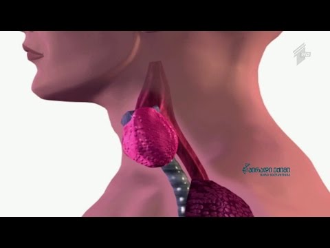 რატომ უნდა ვთქვათ უარი გლუტენზე თუ ფარისებრის პრობლემა გვაქვს?