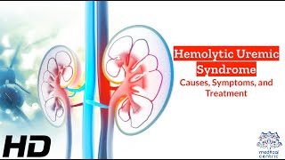 Hemolytic Uremic Syndrome: A Silent Threat Unveiled