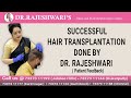 Witness the incredible hair growth journey after hair transplantation  dr rajeshwari j