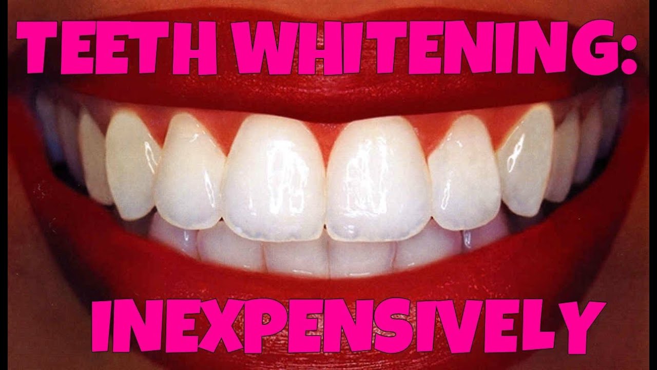 Inexpensive Teeth Whitening YouTube