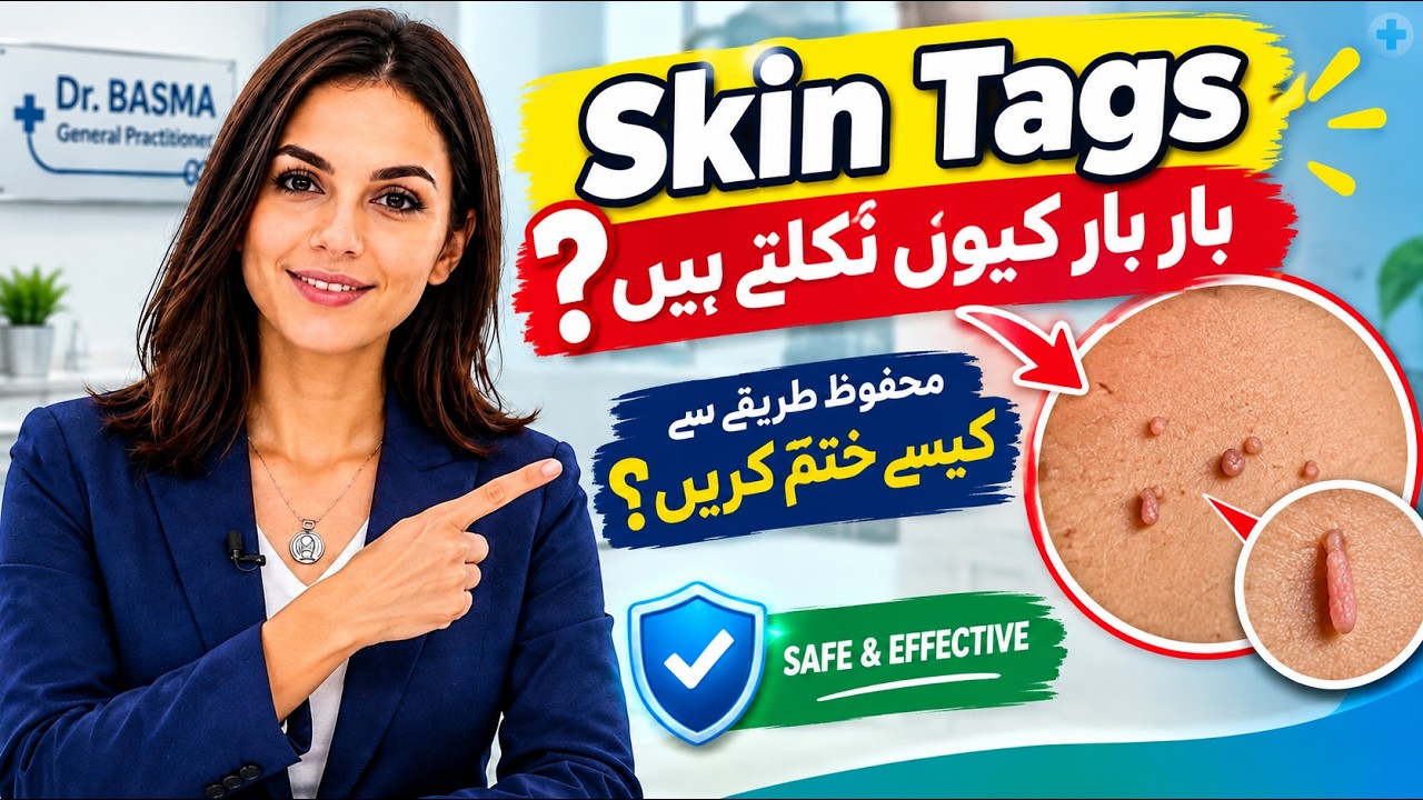 Compound Skin Tag Remove Skin Tags Fast | Basma Health News - YouTube