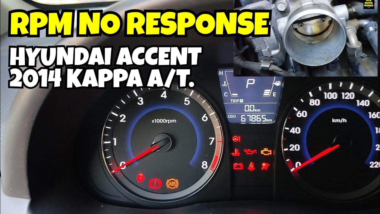 RPM NO RESPONSE HYUNDAI ACCENT 2014 A/T KAPPA. YouTube