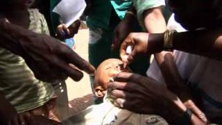 Unicef Polio Is Back In Guinea