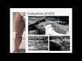 Ultrasound Evaluation of Lower Limb Superficial Veins - Subasit Acharji, MD