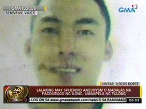 24 Oras: Lalaking may sphenoid aneurysm o madalas na pagdurugo ng ilong, umaapela ng tulong