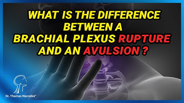 What Are the Types of Brachial Plexus Injuries? Avulsion Vs. Partial Injury!