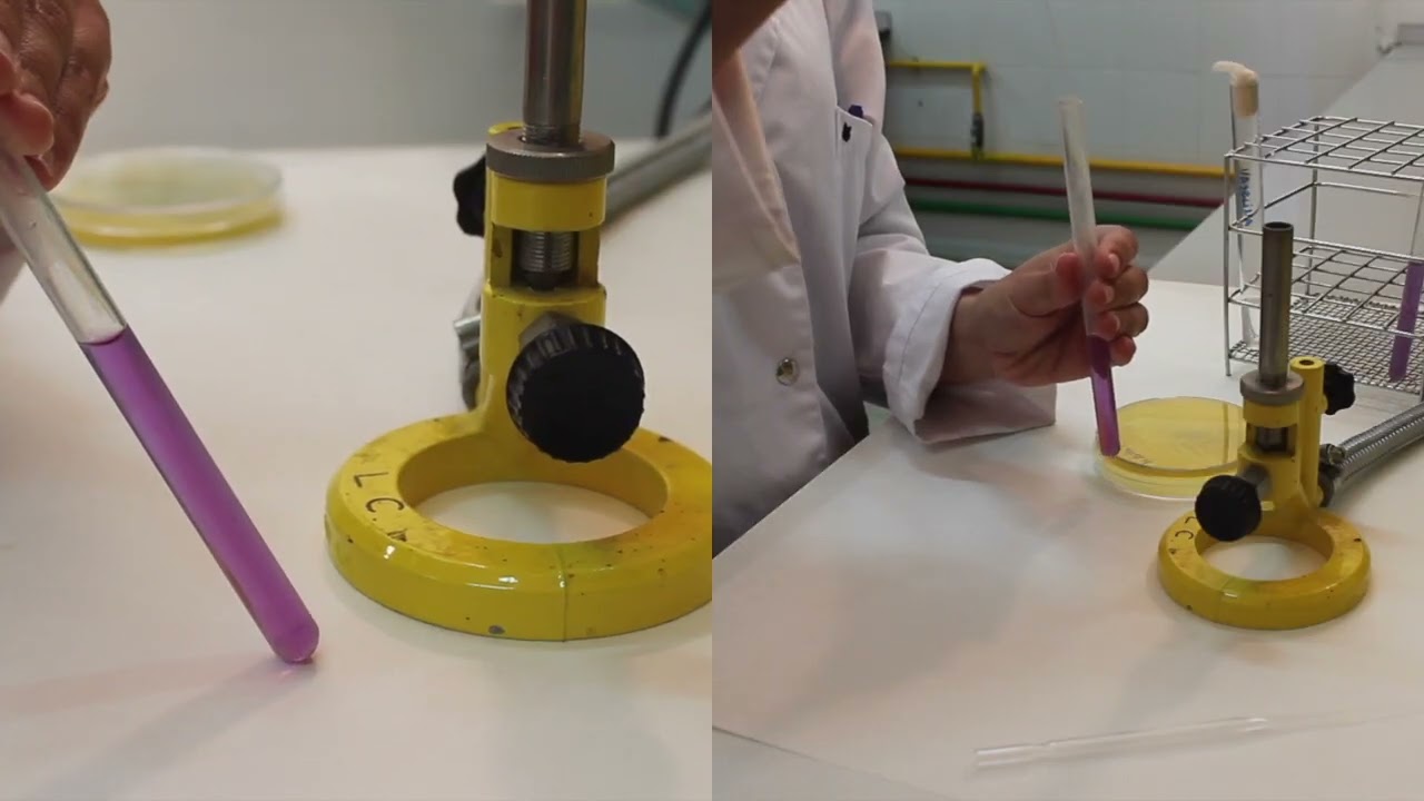 Prueba de la Oxidación/Fermentación de glucosa (O/F)