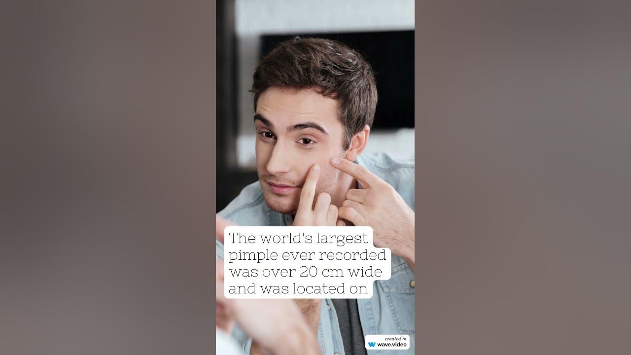 FunFactHealth25The world's largest pimple ever recorded was over 20