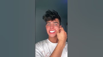 thanks braces #kylethomas #shorts